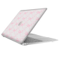 MacBook Snap Case - Coquette Glittery Bow