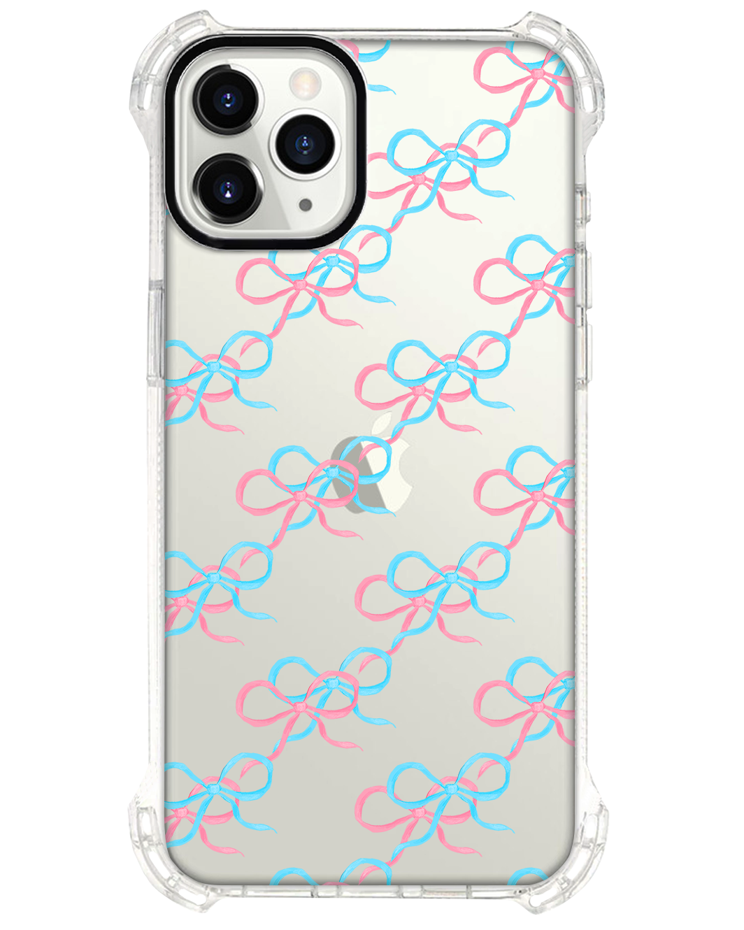 iPhone Rearguard Ultimate - Coquette Pink & Blue Bow